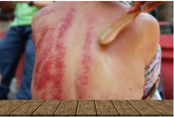 Hija Aktar Pressjoni Aħjar f'Gua Sha?